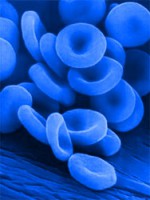 Στον κοσμο υπαρχουν περιπου 7000 ατομα των οποιων το αιμα ειναι μπλε